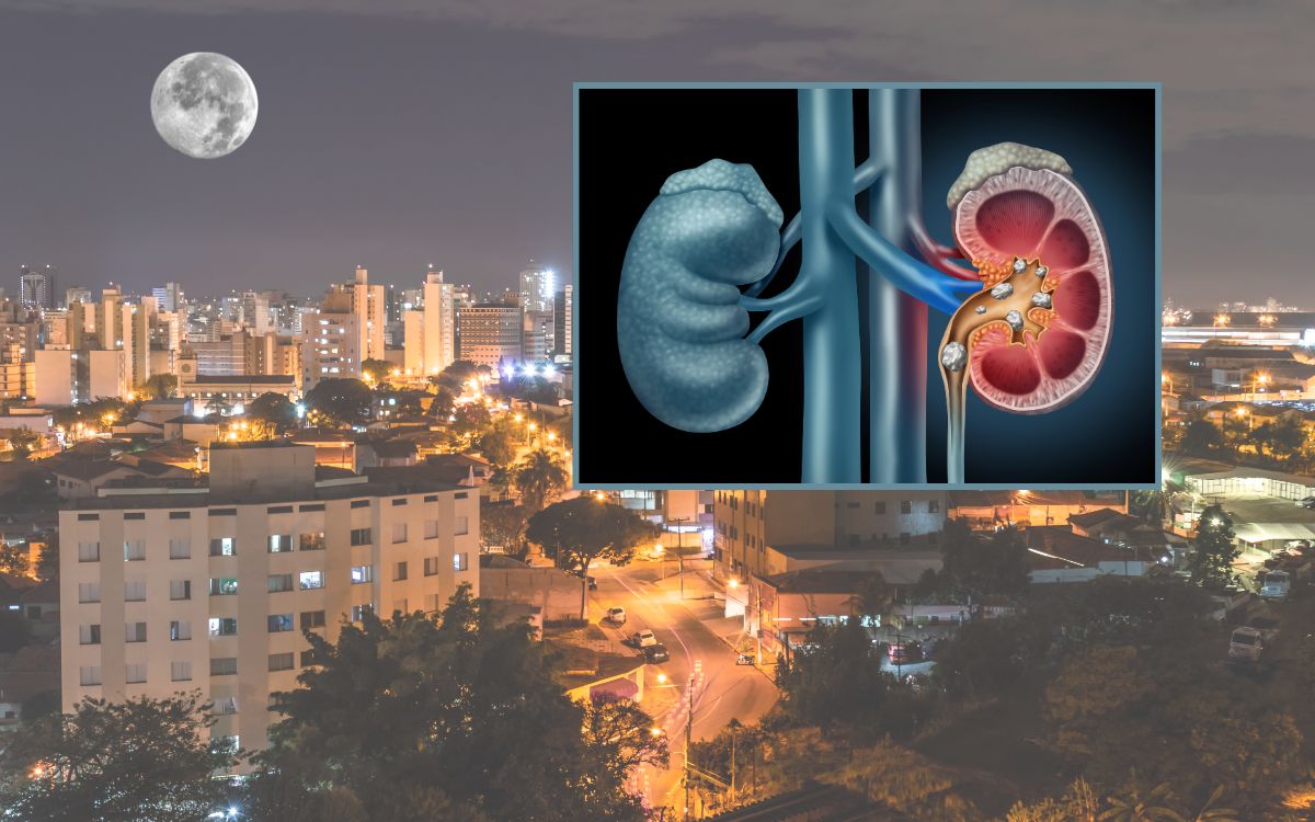Trabalho noturno aumenta risco de pedras nos rins? Estudo revela resposta