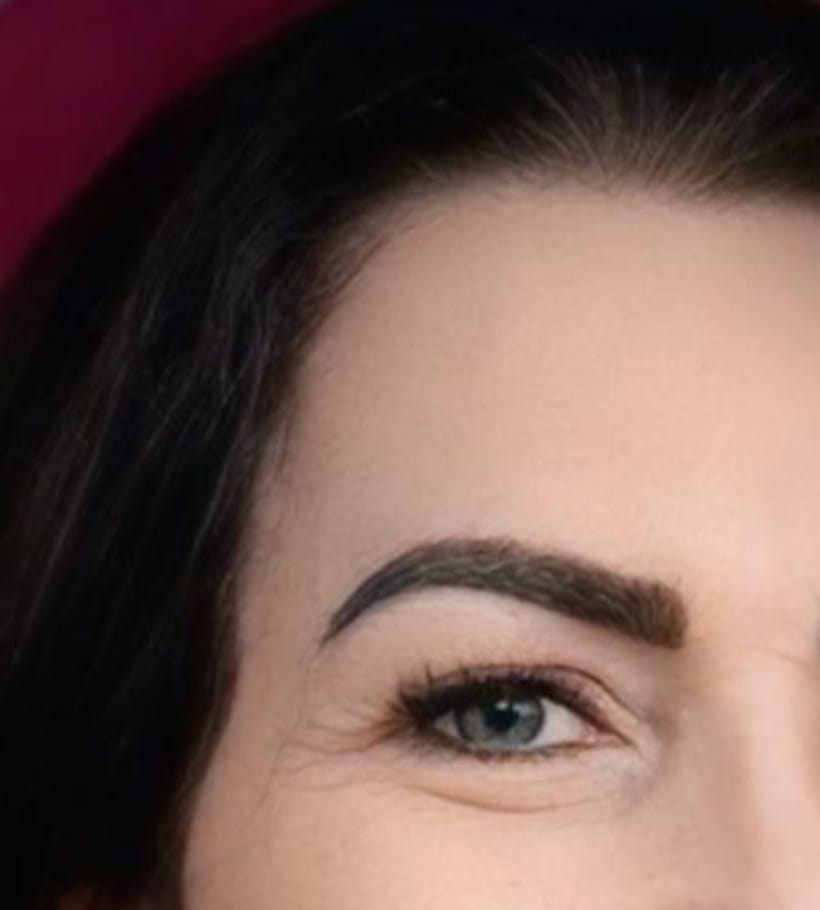 Transplante de sobrancelhas ajuda mulheres a recuperarem autoestima após o câncer